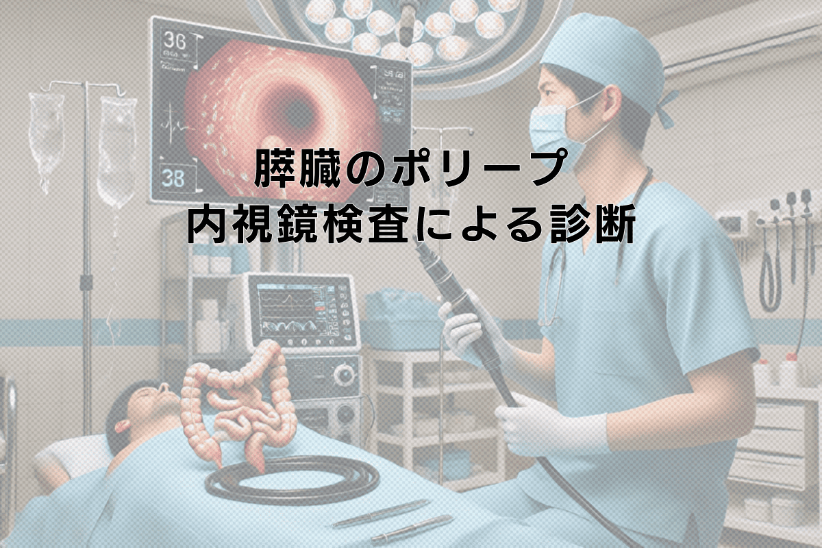 膵臓のポリープと内視鏡検査による診断