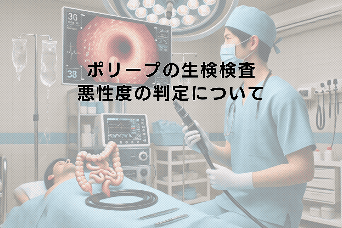 ポリープの生検検査から見る悪性度の判定について