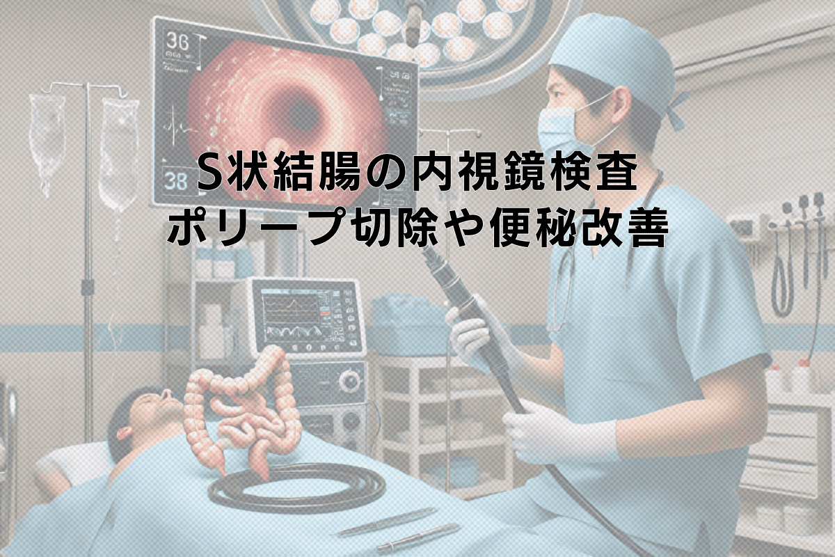 S状結腸の内視鏡検査と治療｜ポリープ切除から便秘改善まで