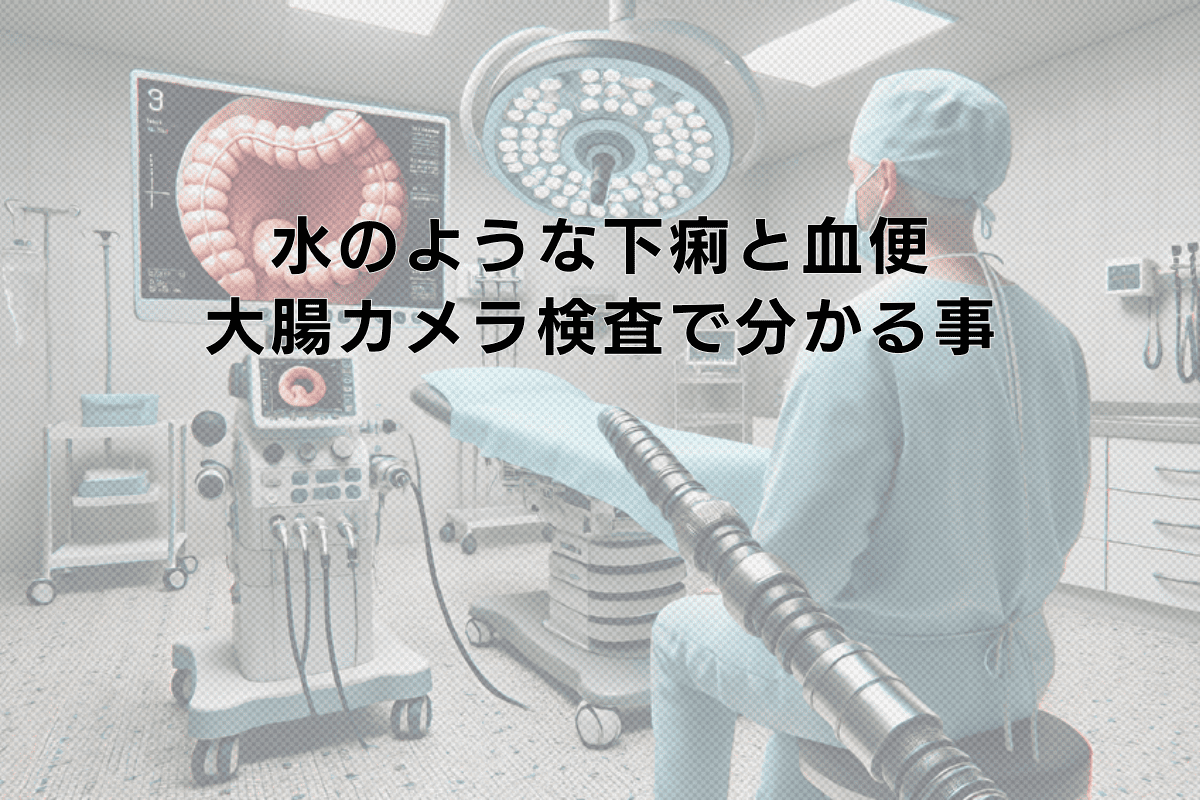 水のような下痢と血便が出る場合の大腸カメラ検査