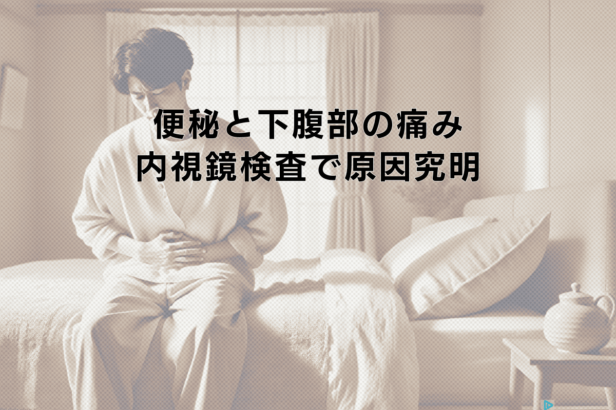 便秘と下腹部の痛み｜大腸内視鏡検査による原因究明