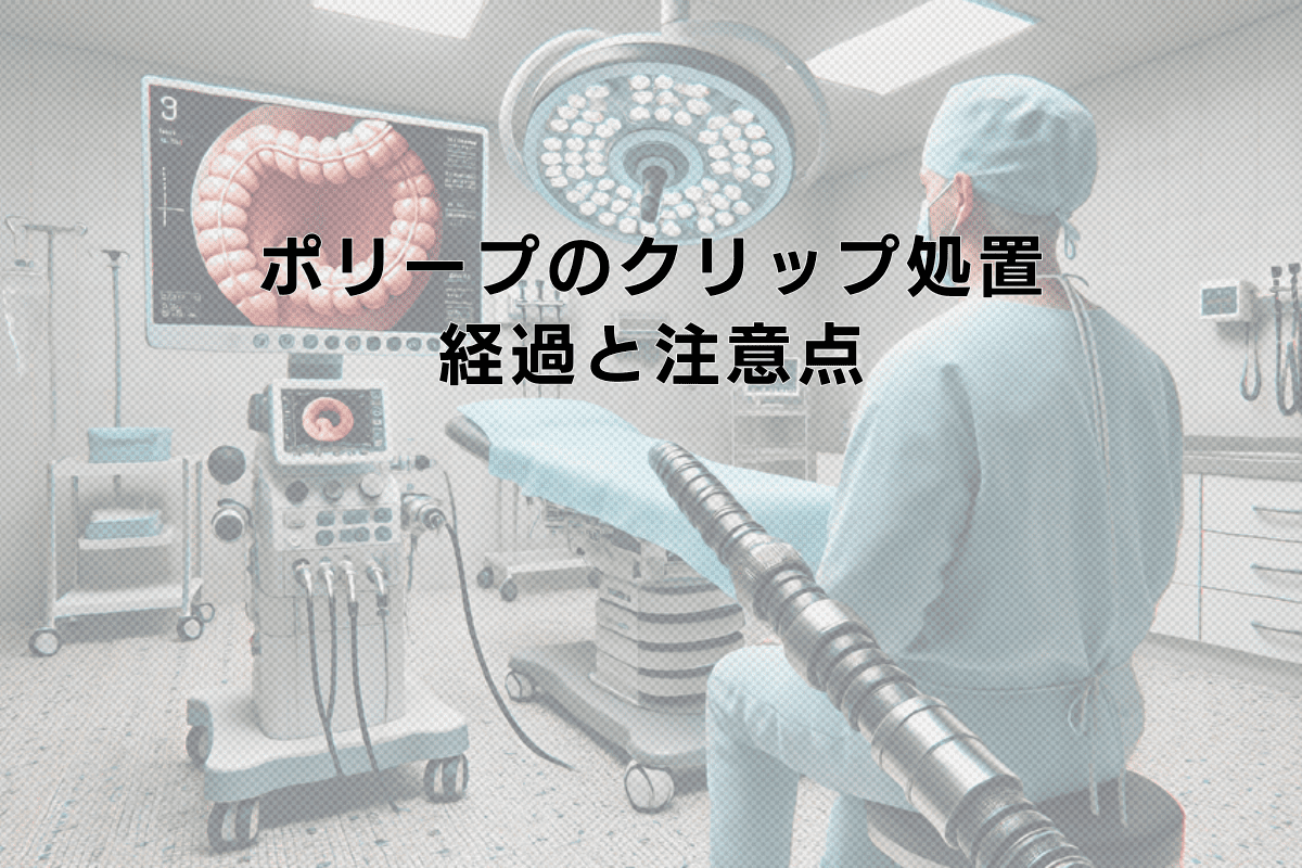 大腸ポリープのクリップ処置後の経過と注意点について