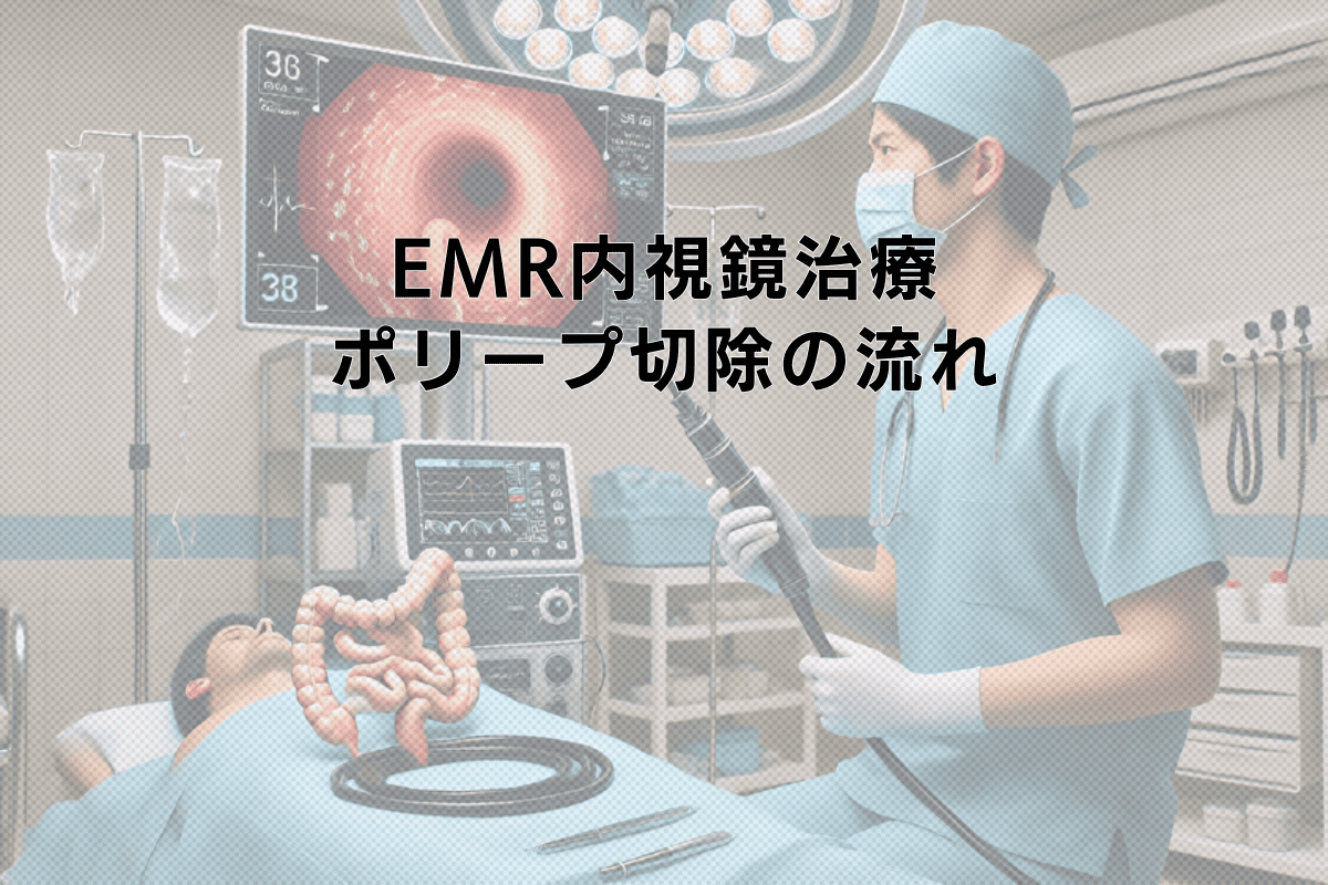 EMR内視鏡治療による大腸ポリープ切除 - 手術の流れと回復期間