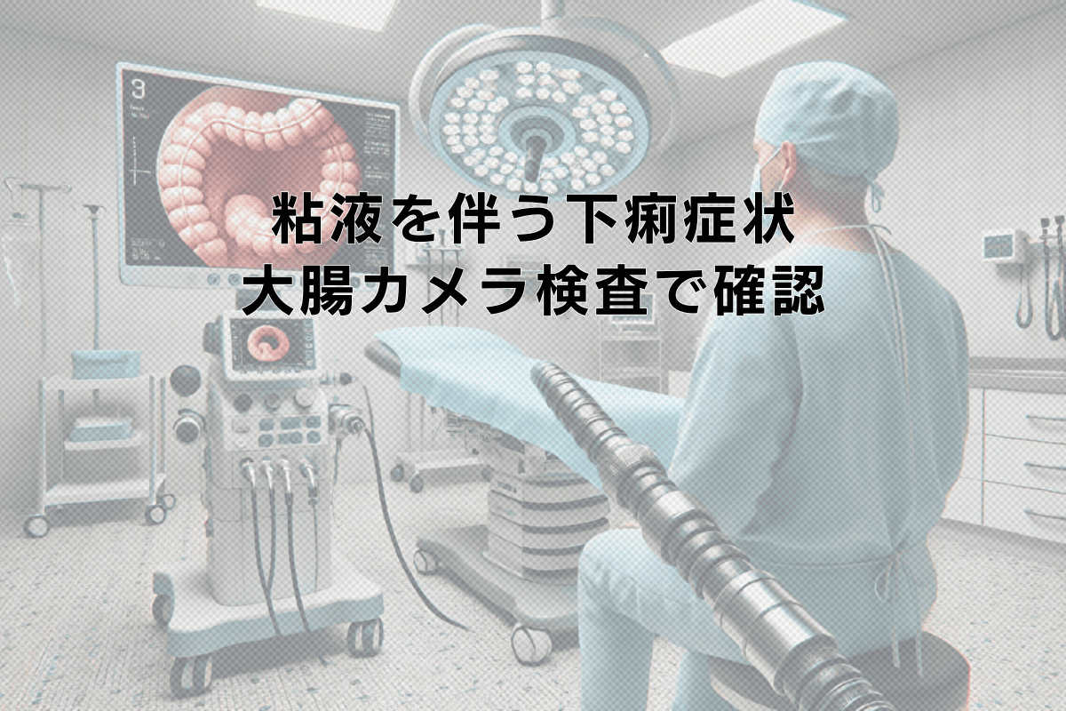 粘液を伴う下痢症状|大腸カメラ検査による粘膜状態の確認