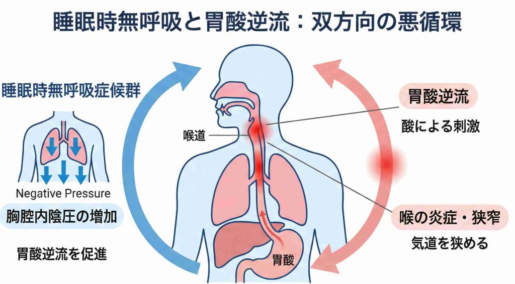 睡眠時無呼吸による胃酸逆流と喉の炎症が悪循環を起こすメカニズム図解