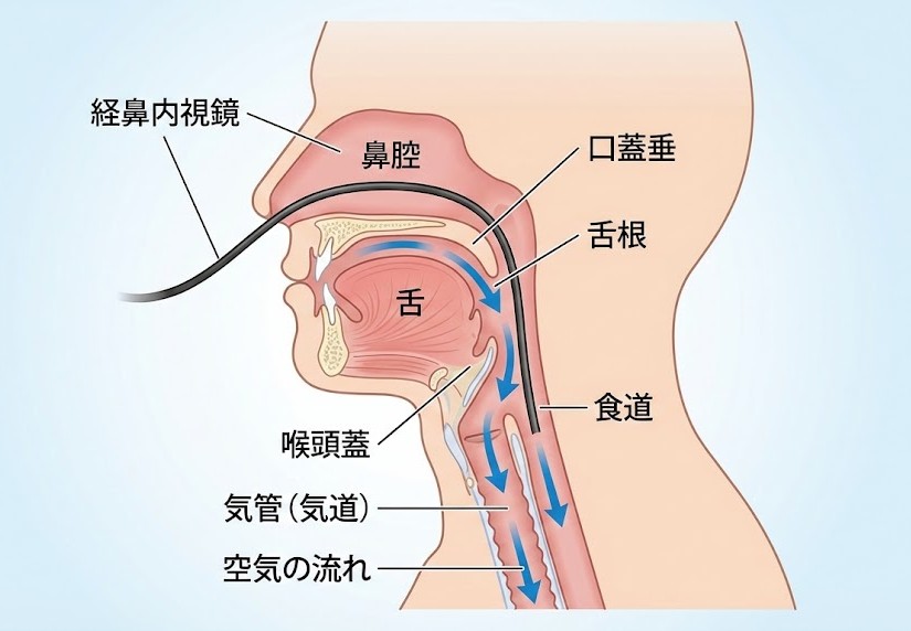 経鼻内視鏡が舌の根元に触れずに食道へ入り、気道が確保されている様子の断面図