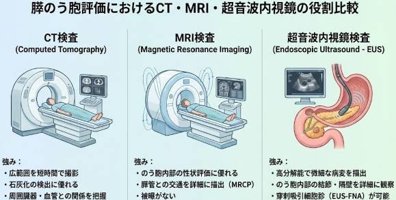 膵のう胞評価におけるCT・MRI・超音波内視鏡の役割を比較した図