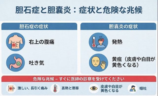 ：胆石・胆嚢炎の典型的症状（右上腹部痛、発熱、吐き気、黄疸）と危険サインを示したインフォグラフィック