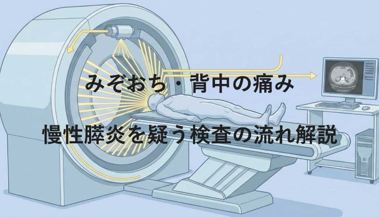 みぞおち・背中の痛み｜慢性膵炎を疑う検査の流れ解説