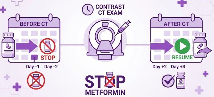 糖尿病薬(メトホルミン)の休薬タイミングを示したインフォグラフィック