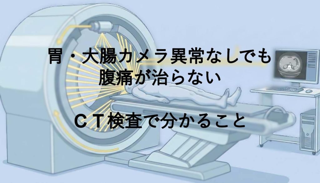 胃・大腸カメラ異常なしでも腹痛が治らない｜CT検査で分かること