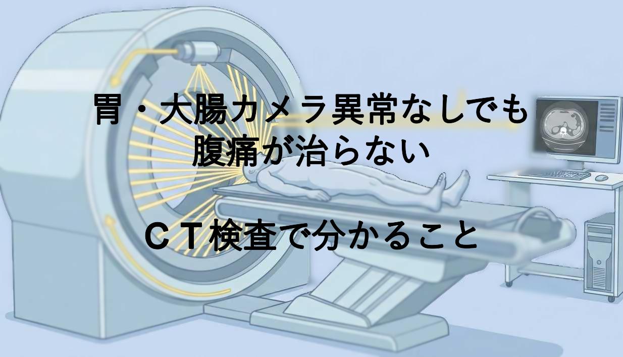 胃・大腸カメラ異常なしでも腹痛が治らない｜CT検査で分かること