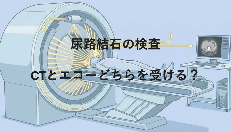 尿路結石の検査でCTとエコーどちらを受ける？違いと注意点