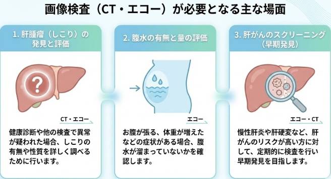 肝腫瘤の発見、腹水の評価、がんスクリーニングなど画像検査が必要となる場面を示した図解