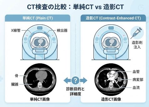 単純CTと造影CTの画像の違いを示す図解イラスト
