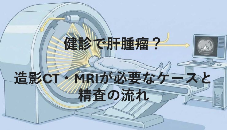 健診で肝腫瘤？造影CT・MRIが必要なケースと精査の流れ