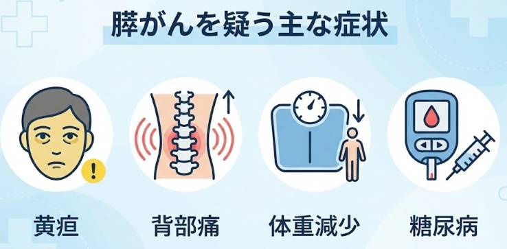 膵がんを疑う主な症状(黄疸・背部痛・体重減少・糖尿病)のアイコン図解