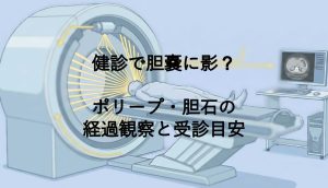 健診で胆嚢に影？ポリープ・胆石の経過観察と受診目安