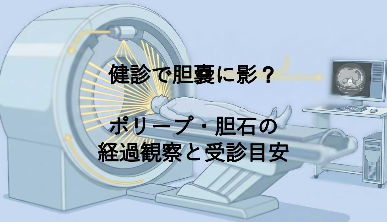 健診で胆嚢に影？ポリープ・胆石の経過観察と受診目安
