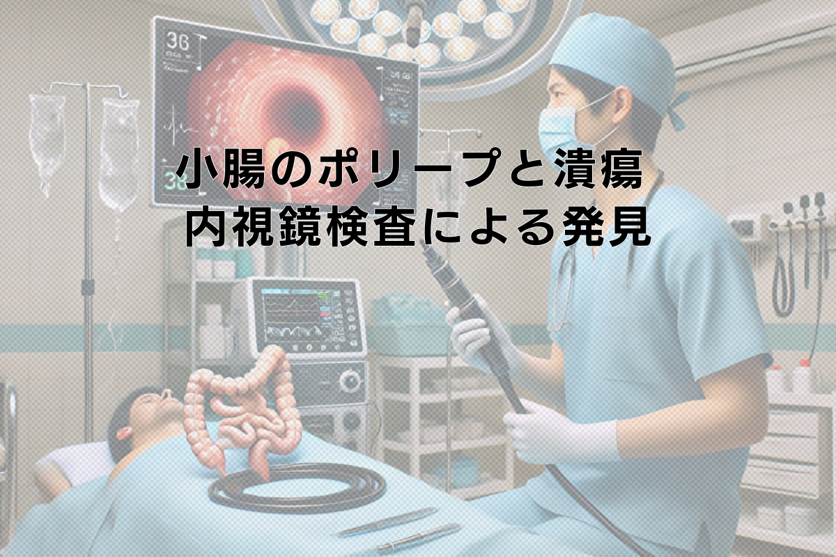 小腸のポリープと潰瘍 - 症状と内視鏡検査による発見