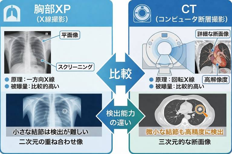 胸部X線とCT検査の違い(感度・被ばく量・使い分け)を比較する図解